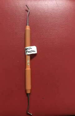 Tdi Hand Instrument BALL BURNISHER+PLASTIC FILLING (COLOUR HANDLE)